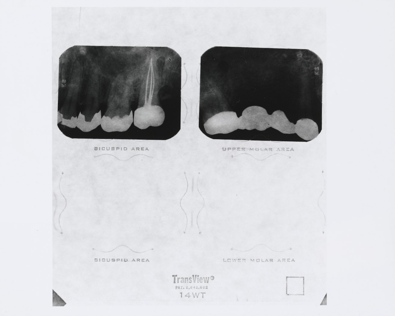 untitled from Roberta's External Transformations from Roberta       [Roberta's dental X ray]