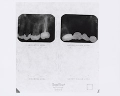 untitled from Roberta's External Transformations from Roberta       [Roberta's dental X ray]