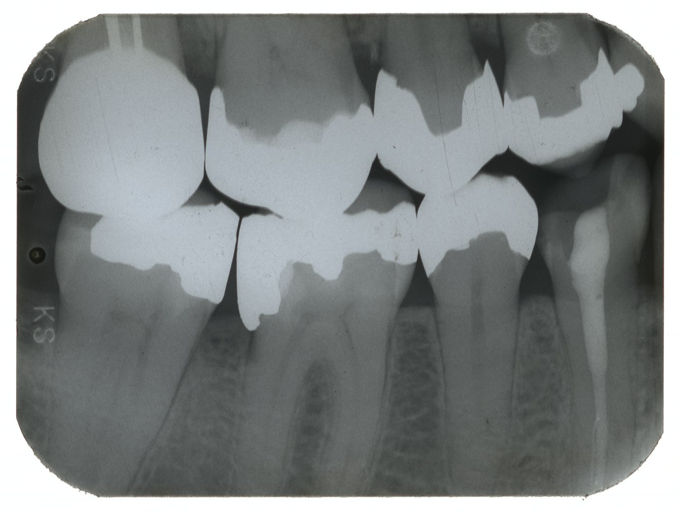 untitled from Objects from Roberta       [Roberta's dental X ray]