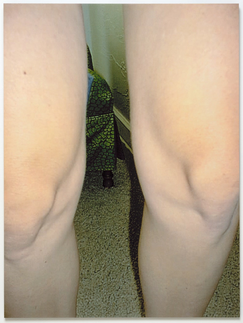 Untitled (Knees)