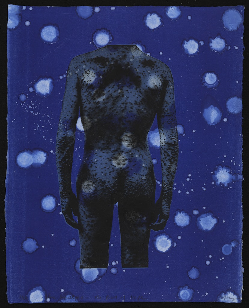 Blue Small Pox – The Print of Hope