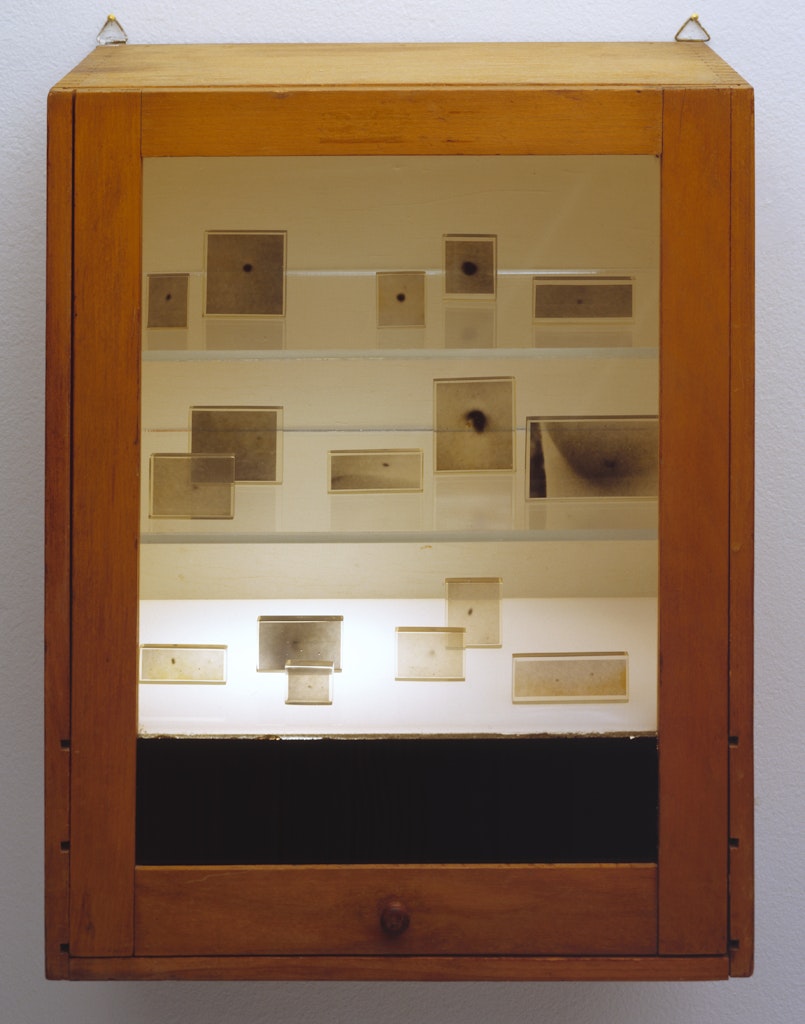 Chest of Moles (Portrait of Pamela)