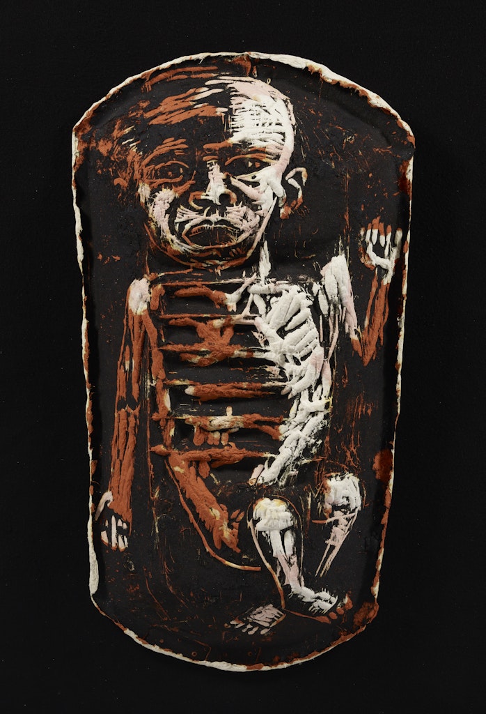 Starving African Babies with AIDS