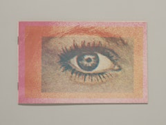 Scotoma: Blind Spots in the Visual Field
