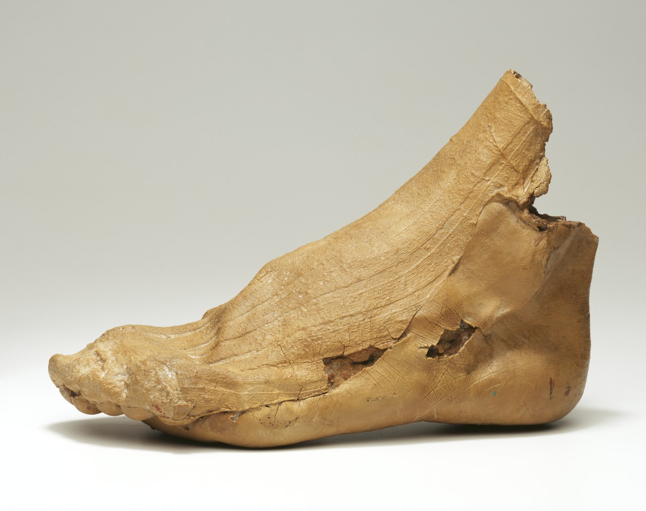 Outer side of foot