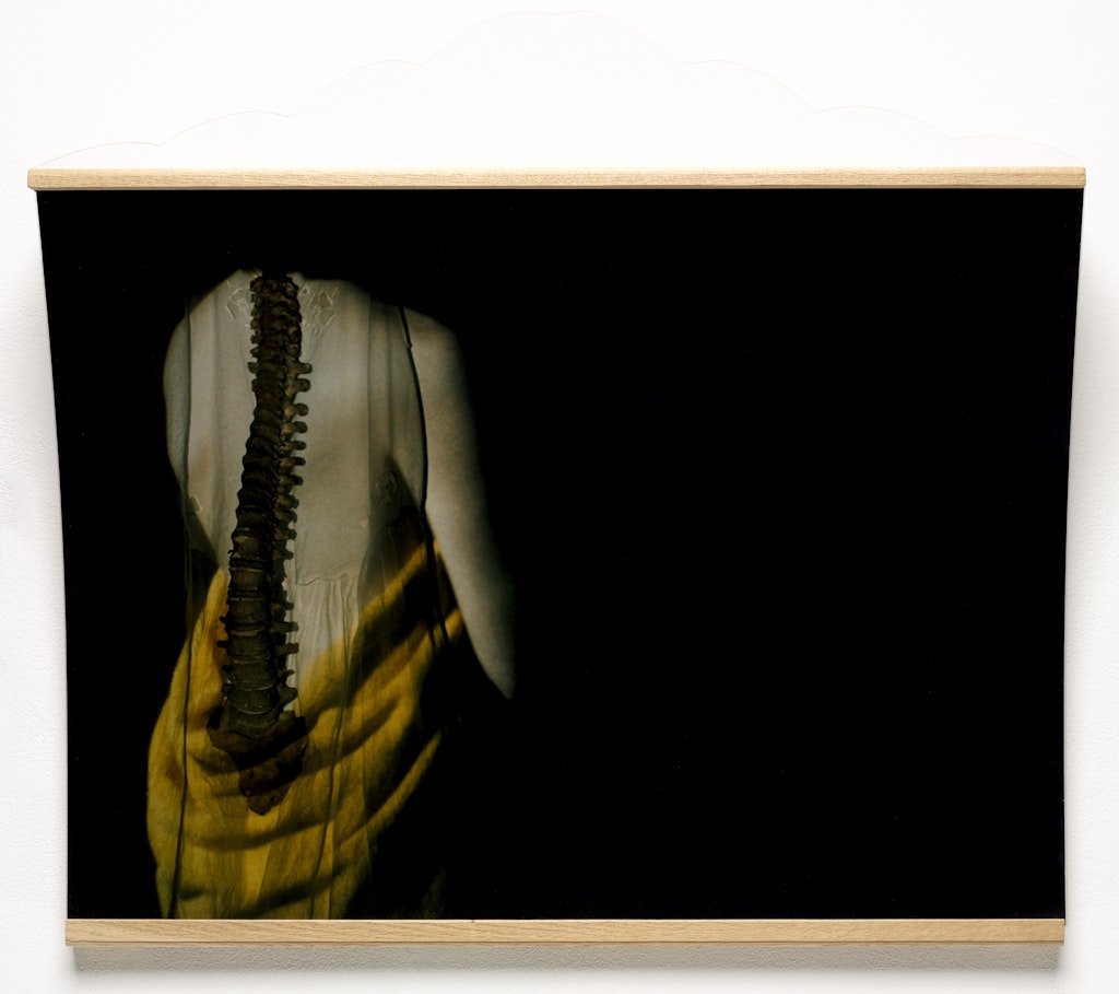 Spine from The Nervous System